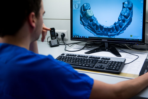 Eine Person in blauem Kittel schaut auf einen Computerbildschirm, auf dem ein 3D-Zahnmodell angezeigt wird, und auf dem Schreibtisch liegen eine Tastatur und Büroartikel.